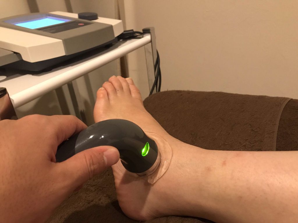 捻挫の超音波治療