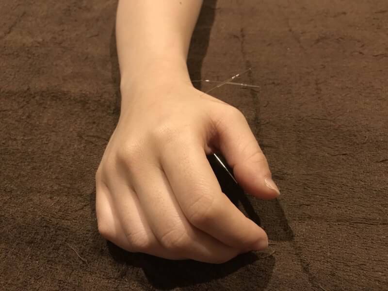 運動鍼